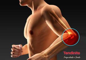 fisioterapia_atleta_tendinite_cotovelo_epicondilite_lateral