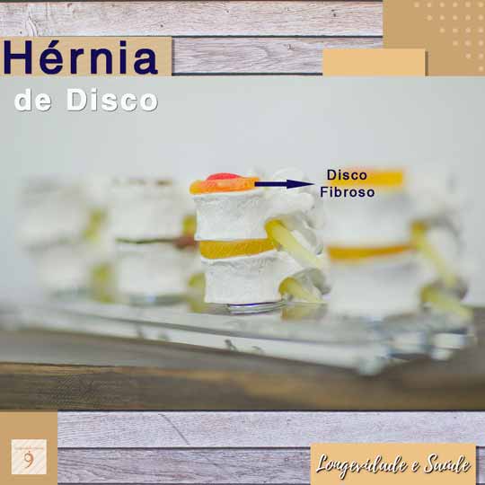 Hérnia de Disco  Osteopatia e Saúde